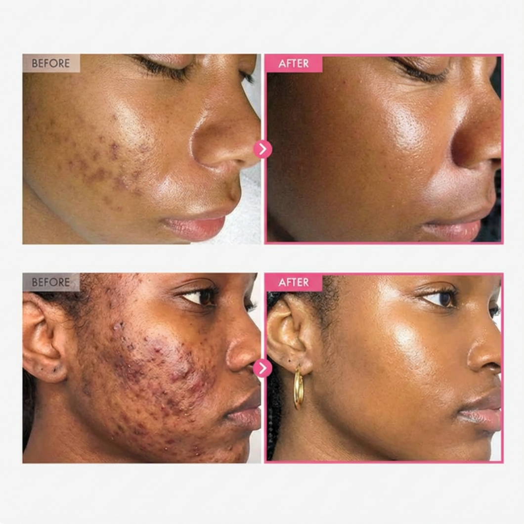 Radiant Skin Brightening Cream™